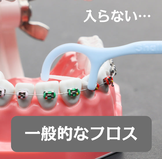 矯正用フロス